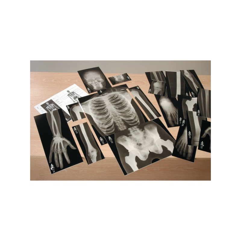 Human Skeleton True To Life